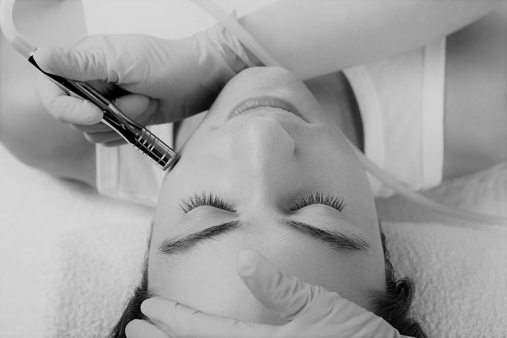 MIcrodermabrasion cost